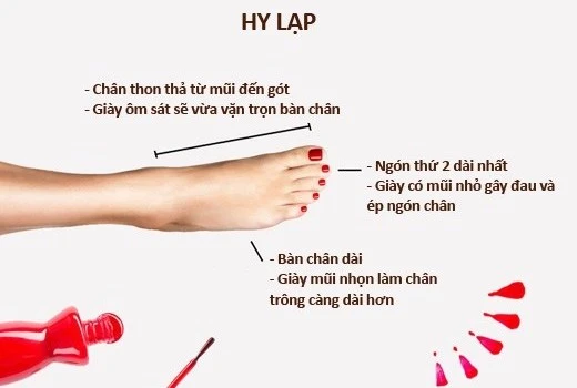 Dáng bàn chân Hy Lạp