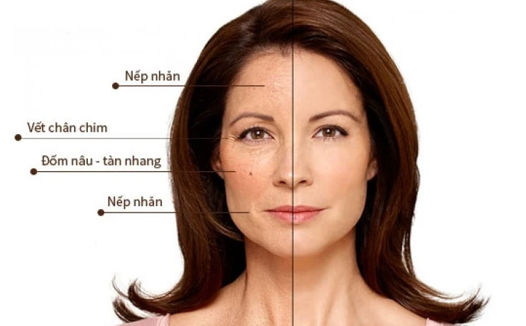 Qua trình lão hóa bắt đầu ở tuổi trung niên
