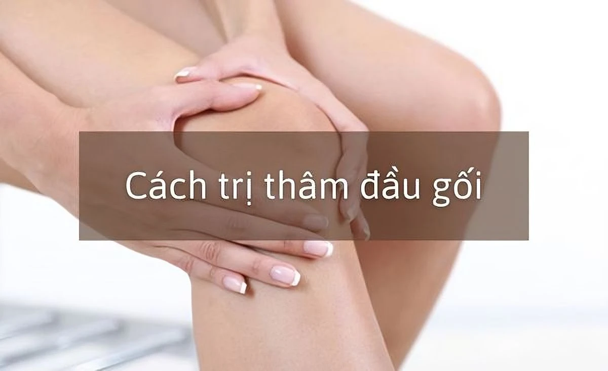Cách trị thâm đầu gối nhanh chóng nhờ Vaseline chỉ với các bước đơn giản tại nhà